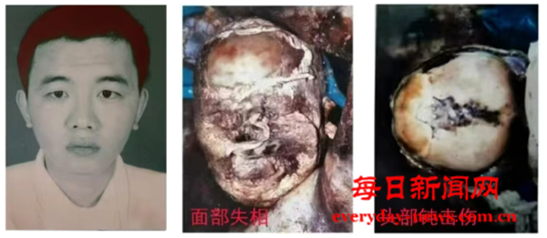 案123号连接111111111.png 案123号连接111111111.png